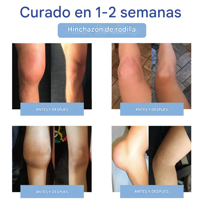 🔥PROMO 2x1 Ourlyard™ - Crema de magnesio para aliviar el dolor de huesos 👨‍⚕️🔥