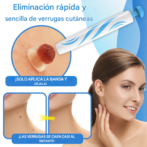 TagBuddy Pro™ - Kit de eliminador de Verrugas