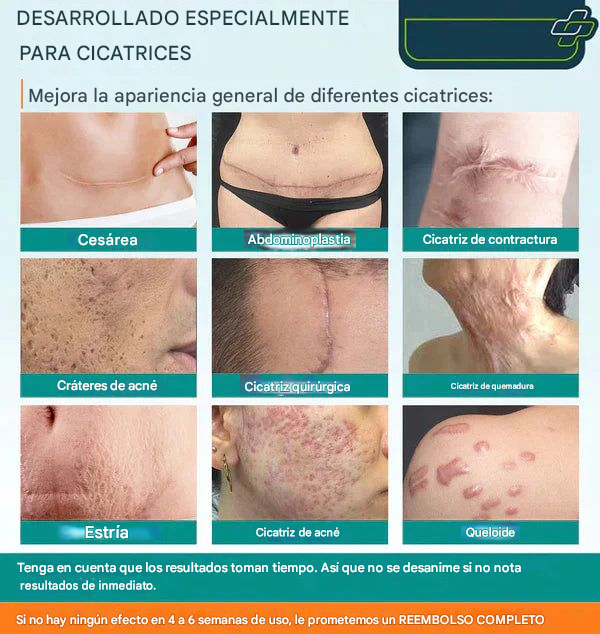 ✨ CicatriFix™ – La Solución Avanzada para una Piel Perfecta ✨