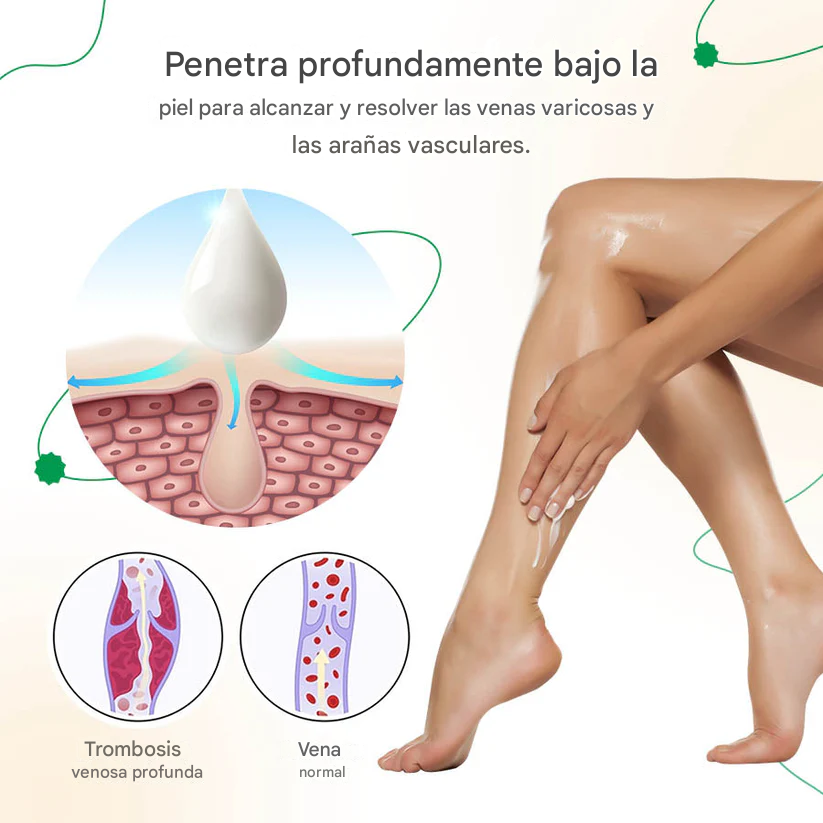 ODALIT™ Crema Para Las Venas Varices