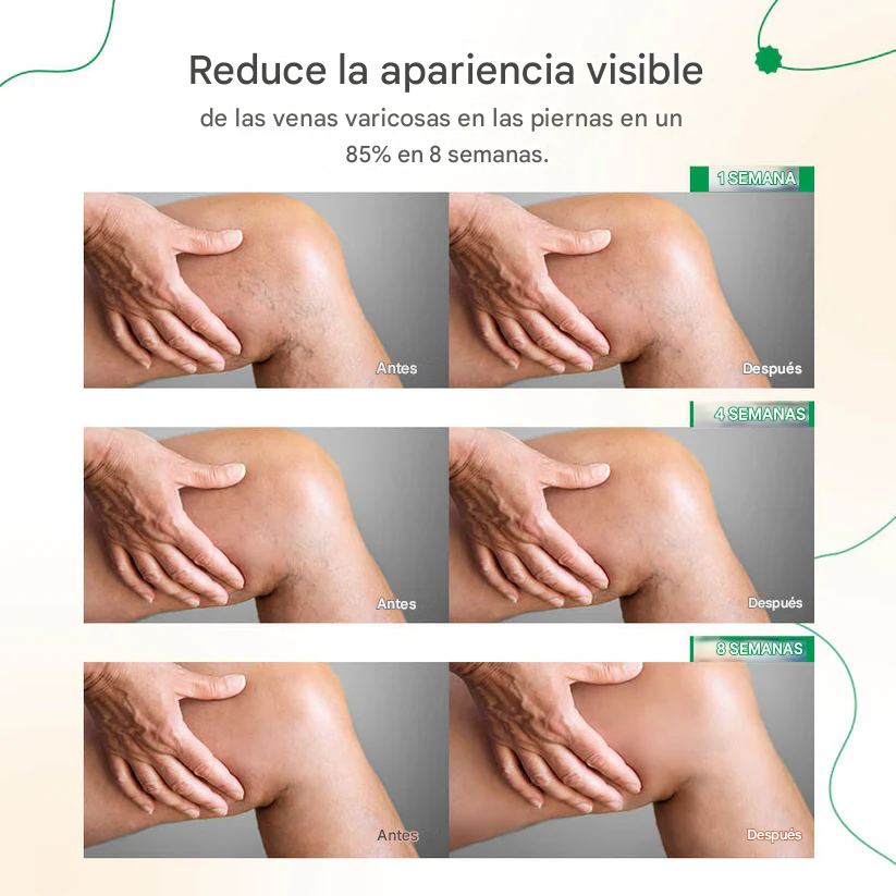 ODALIT™ Crema Para Las Venas Varices