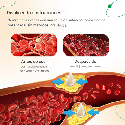ODALIT™ Crema Para Las Venas Varices