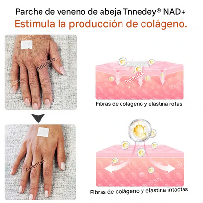 Tnnedey® - Parche de veneno de abeja rejuvenecimiento de la piel y aumento de energía