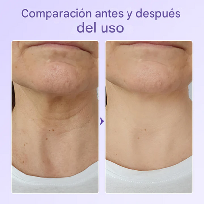 Parche antiarrugas con péptidos Biancat®