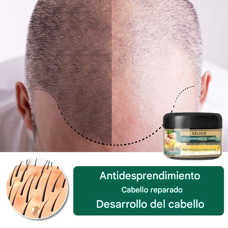 🔥PROMO 2x1 GingerGrow™ Active Formula - Crema De Jengibre Para El Crecimiento Del Cabello🔥