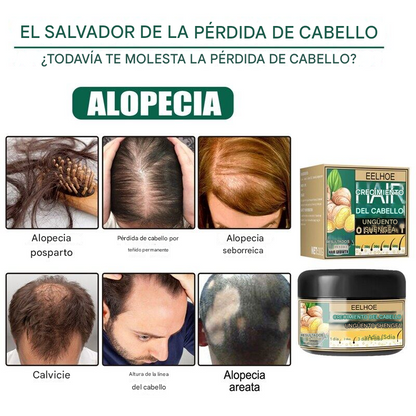 🔥PROMO 2x1 GingerGrow™ Active Formula - Crema De Jengibre Para El Crecimiento Del Cabello🔥