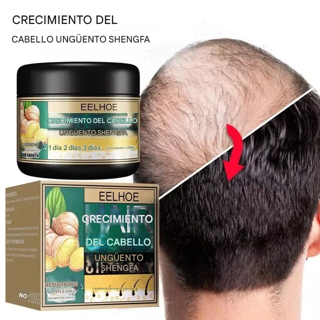 🔥PROMO 2x1 GingerGrow™ Active Formula - Crema De Jengibre Para El Crecimiento Del Cabello🔥