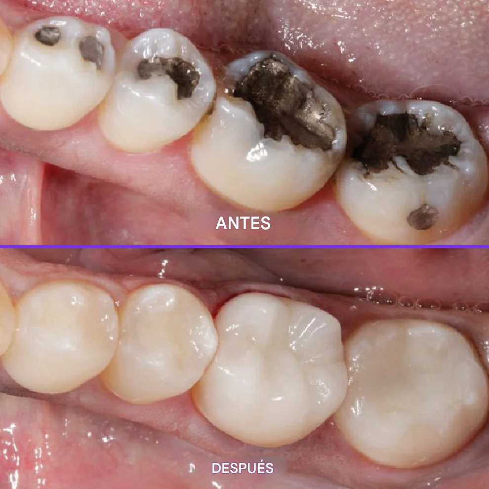 Pasta Dental Con Flúor - SensiGum