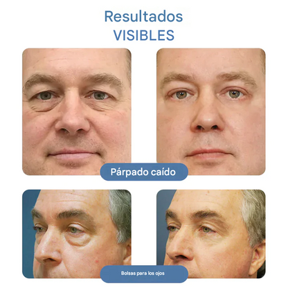 OpenEyes - Crema Anti-Ojeras Con Retinol AntiEdad