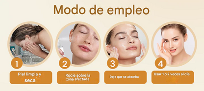 BeeEssence® - Spray Removedor De Verrugas