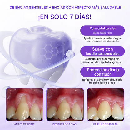 Pasta Dental Con Flúor - SensiGum