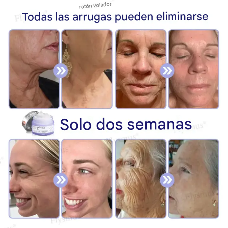 Crema Reafirmante Flysmus® AH-8