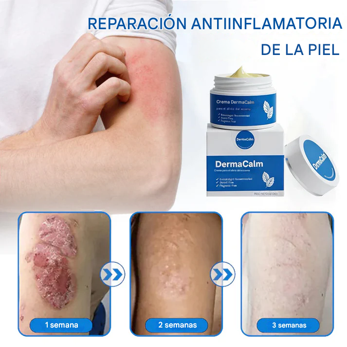 DermaCalm Magnesio Herbal Intimate - Alivio Rápido Para La Psoriasis, El Eccema Y La Picazón