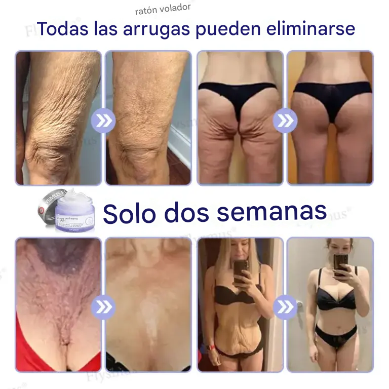 Crema Reafirmante Flysmus® AH-8