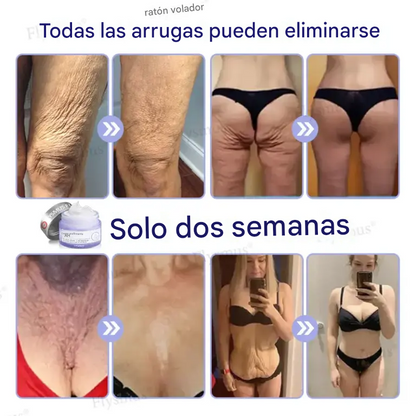 Crema Reafirmante Flysmus® AH-8