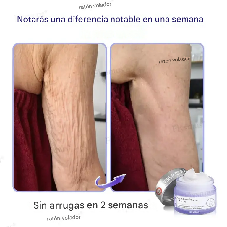 Crema Reafirmante Flysmus® AH-8