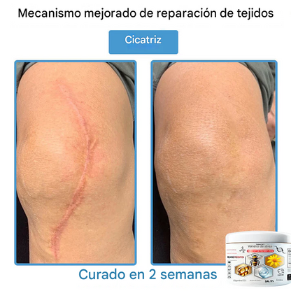 TOD𝐀HOF™ - Crema Para El Tratamiento De La Piel