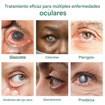 Ourlyard® - Gotas Para Los Ojos - Apto para presbicia, síndrome del ojo seco, glaucoma y cataratas