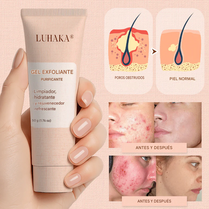 Luhaka® Gel Exfoliante Purificante ACE 3 Para Acantosis Nigricans, Exfoliación, Manchas Oscuras, Acrocordones y Eczema