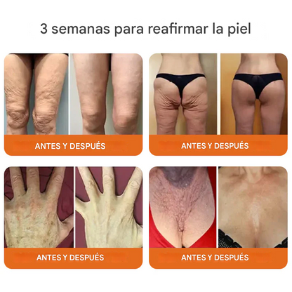 🔥🐝(PROMO 2x1 ) Flysmus™ Suero reafirmante con veneno de abeja y botox🐝🔥