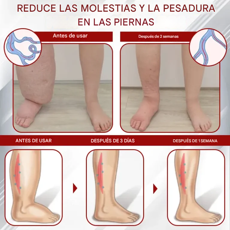 Red Vine ® - Crema De Gel Para Aliviar Los Edemas