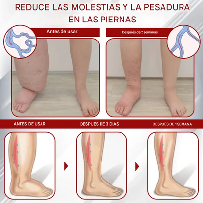 Red Vine ® - Crema De Gel Para Aliviar Los Edemas