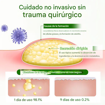 Biancat® - Crema Para La Eliminación De Lipomas