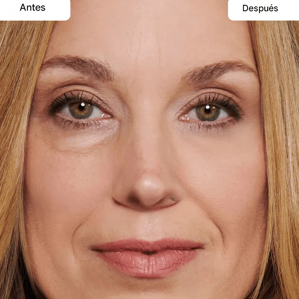 Crema Eliminadora De bolsas Y Arrugas Alrededor De Los Ojos.