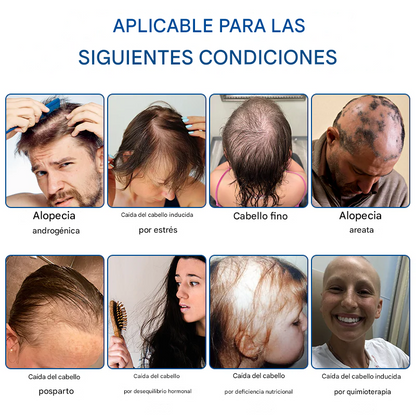 Rodillo Capilar Croaie - STEM Cell Hair Cycle Roller