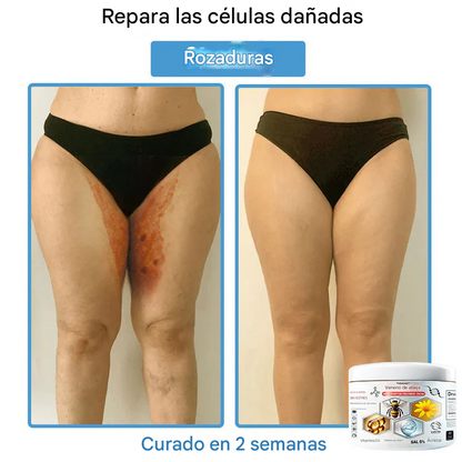 TOD𝐀HOF™ - Crema Para El Tratamiento De La Piel