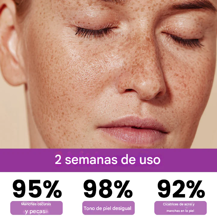 ✨Ceoerty® MelantraX - Esencia Anti Hiperpigmentación