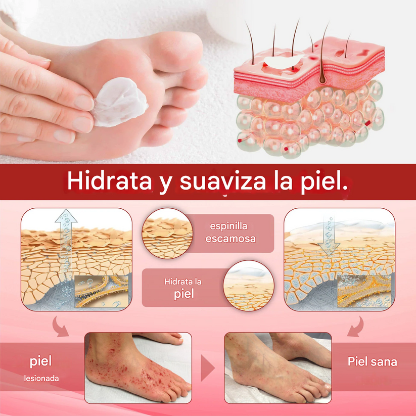 GlucoseGuard Crema de rescate para la piel