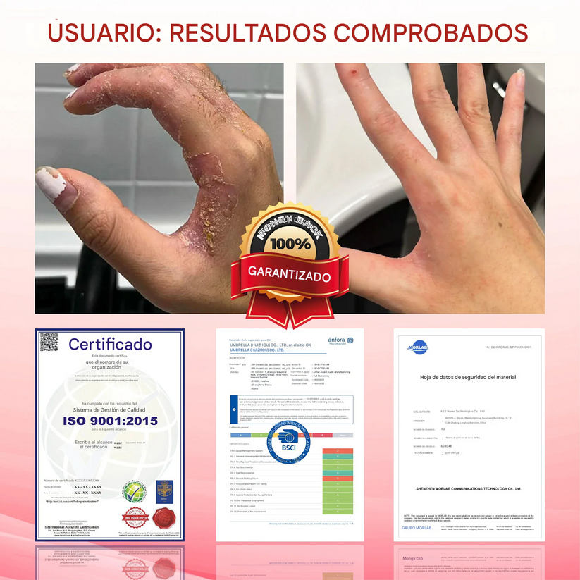 GlucoseGuard Crema de rescate para la piel