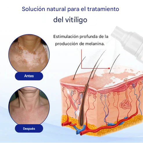 PROMO 2X1 - Evenora® Spray De Hierbas Para Las Manchas