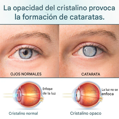 OptiFusion Nano - Suero oftalmológico en gotas para la restauración de la visión