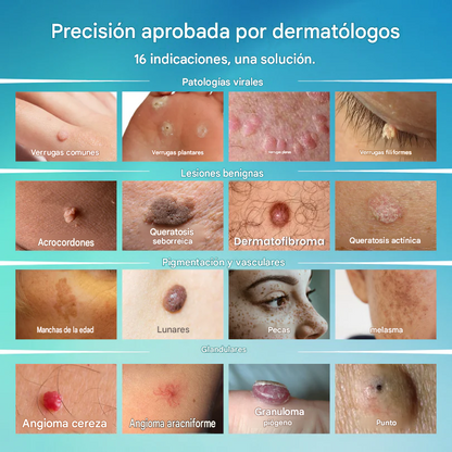 Lápiz De Cuidado Avanzado Para Eliminar Verrugas Y Imperfecciones De La Piel