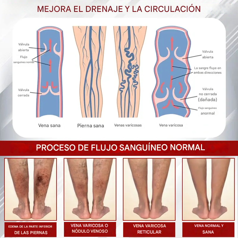 Red Vine ® - Crema De Gel Para Aliviar Los Edemas
