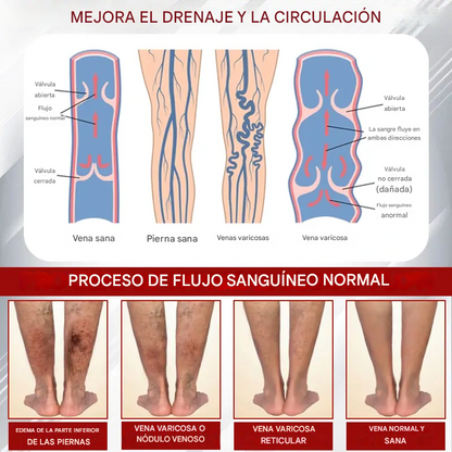 Red Vine ® - Crema De Gel Para Aliviar Los Edemas