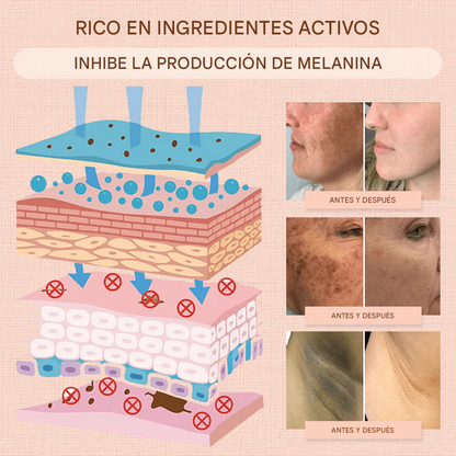 Luhaka® Gel Exfoliante Purificante ACE 3 Para Acantosis Nigricans, Exfoliación, Manchas Oscuras, Acrocordones y Eczema