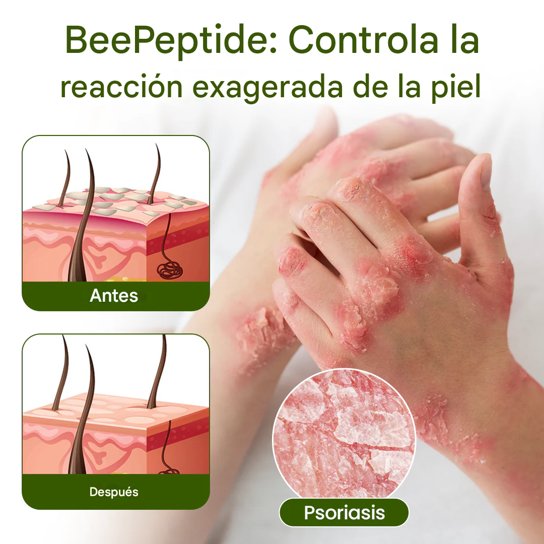 PROMO 2x1 🔥BeePeptide ® - Crema Para La Dermatitis Y Problemas De La Piel