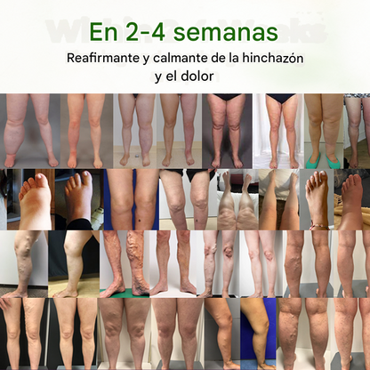 Crema Antiedema "FluidEase" de Timilk® — ✅ ¡Clínicamente probada en solo 7 días!