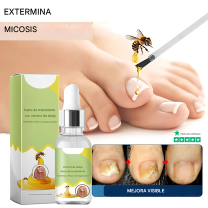 🔥🐝Promo 2x1 Nail Shield™ - Protector de uñas - Detén las uñas dañadas para siempre🐝🔥