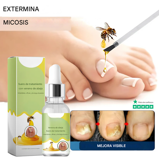 🔥🐝Promo 2x1 Nail Shield™ - Protector de uñas - Detén las uñas dañadas para siempre🐝🔥