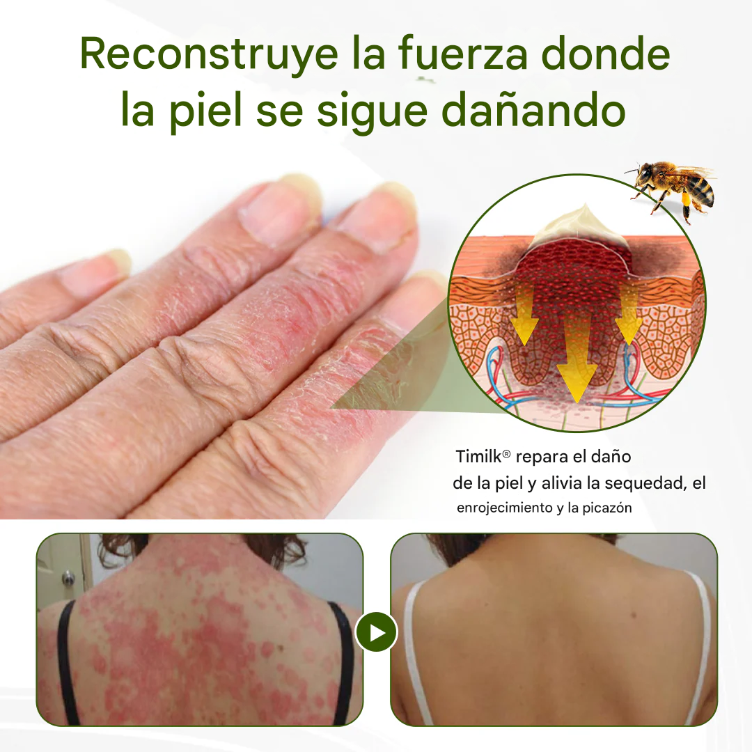 PROMO 2x1 🔥BeePeptide ® - Crema Para La Dermatitis Y Problemas De La Piel