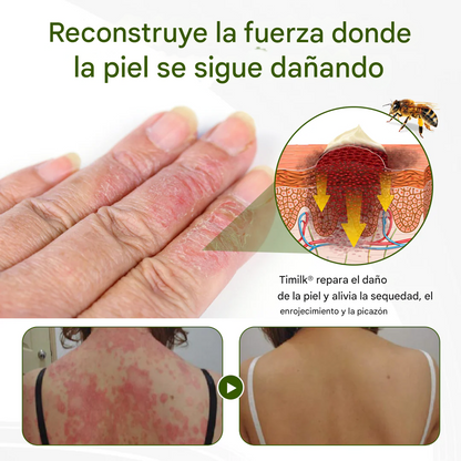 PROMO 2x1 🔥BeePeptide ® - Crema Para La Dermatitis Y Problemas De La Piel