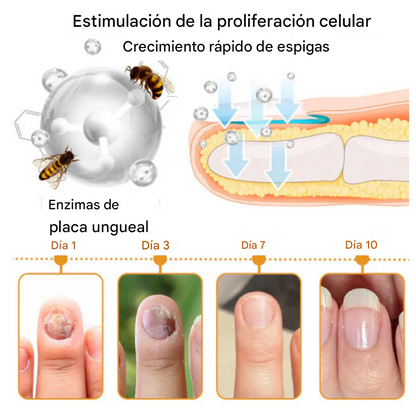 🔥🐝Promo 2x1 Nail Shield™ - Protector de uñas - Detén las uñas dañadas para siempre🐝🔥