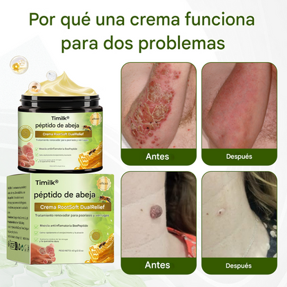 PROMO 2x1 🔥BeePeptide ® - Crema Para La Dermatitis Y Problemas De La Piel