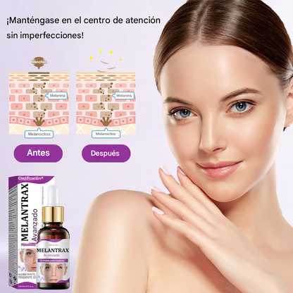 ✨Ceoerty® MelantraX - Esencia Anti Hiperpigmentación