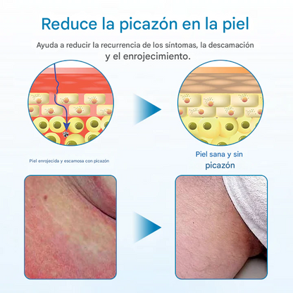Timilk® - Crema De Alivio GentX