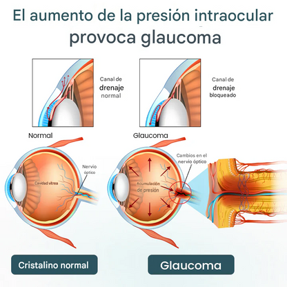OptiFusion Nano - Suero oftalmológico en gotas para la restauración de la visión